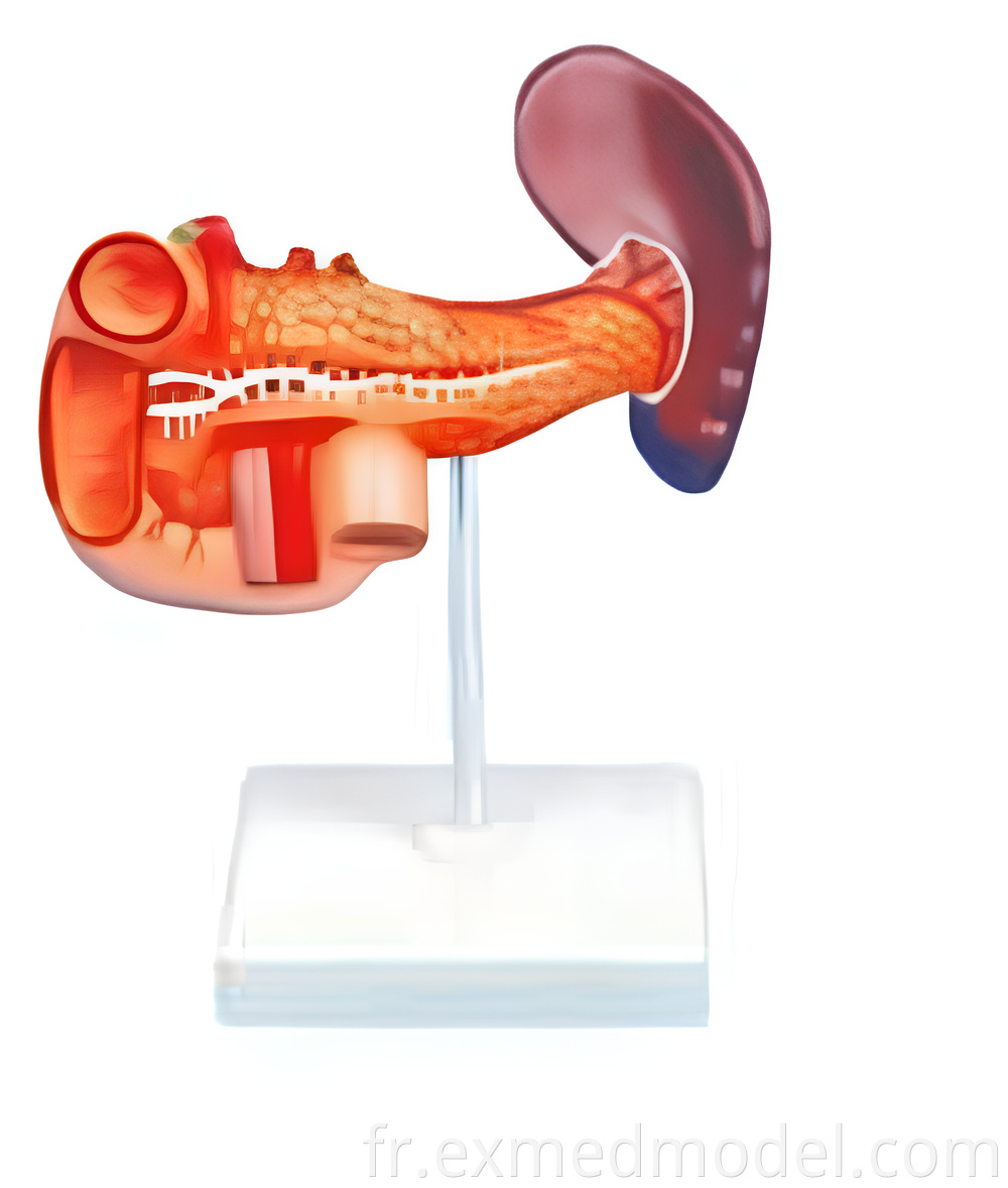 Pancreas, Spleen and Duodenum